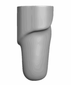 Eine positiv-Fräsung eines Oberschenkels